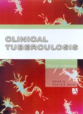 Clinical Tuberculosis