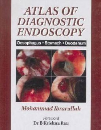 Atlas Of Diagnostic Endoscopy by B Krishma Rau