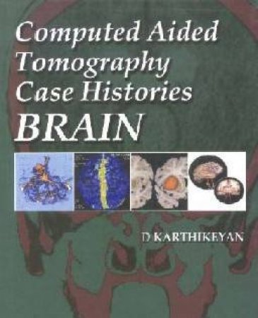 Computer Aided Tomography Case Histories Of The Brain by D Karthikeyan