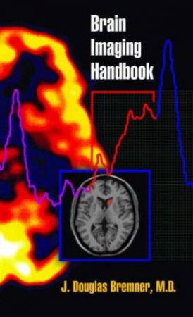 Brain Imaging Handbook by J Douglas Bremner