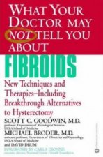 What Your Doctor May Not Tell You About Fibroids