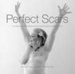 Perfect Scars