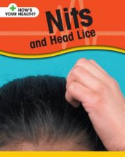 Hows Your Health Nits And Head Lice