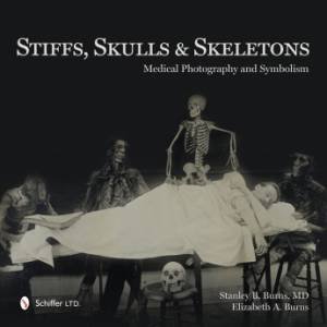 Stiffs, Skulls and Skeletons by BURNS MD STANLEY B.