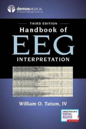 Handbook Of EEG Interpretation by IV William O. Tatum