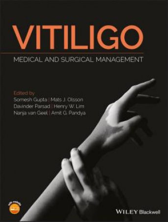 Vitiligo: Medical And Surgical Management by Somesh Gupta