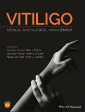 Vitiligo Medical And Surgical Management