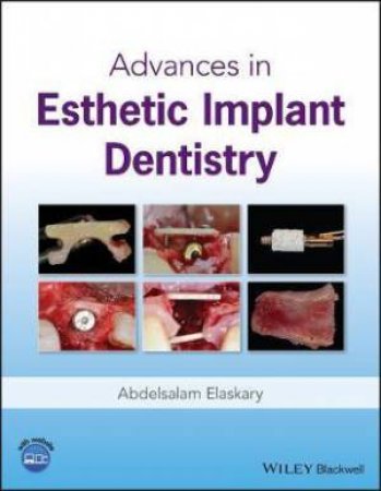 Advances In Esthetic Implant Dentistry by Abd El Salam El Askary