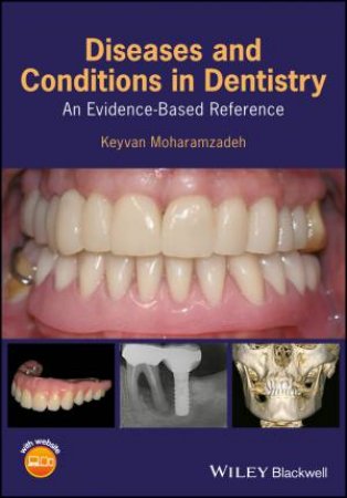 Diseases And Conditions In Dentistry: An Evidence-Based Reference by Keyvan Moharamzadeh