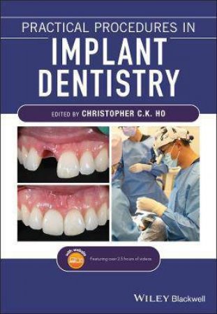 Practical Procedures In Implant Dentistry by Christopher C. K. Ho