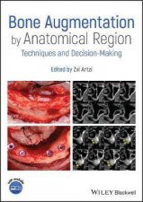 Bone Augmentation By Anatomical Region