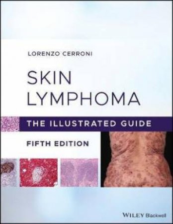 Skin Lymphoma by Lorenzo Cerroni