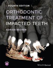 Orthodontic Treatment Of Impacted Teeth