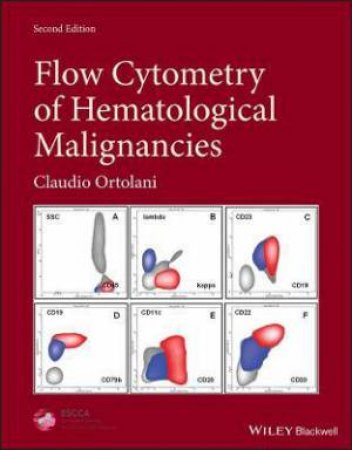 Flow Cytometry Of Hematological Malignancies by Claudio Ortolani