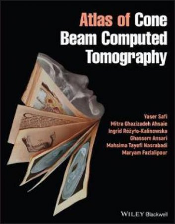 Atlas Of Cone Beam Computed Tomography by Yaser Safi & Mitra Ghazizadeh Ahsaie & Ingrid Rózylo-Kalinowska & Ghassem Ansari & Mahsima Tayefi Nasrabadi & Maryam Fazlalipour