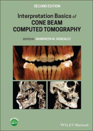 Interpretation Basics Of Cone Beam Computed Tomography by Shawneen M. Gonzalez