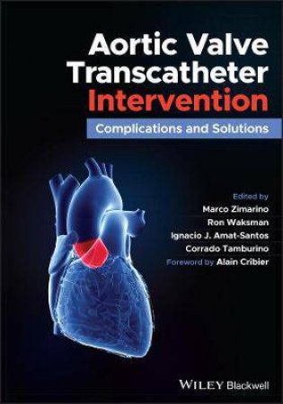 Aortic Valve Transcatheter Intervention by Marco Zimarino & Ron Waksman & Ignacio J. Amat-Santos & Corrado Tamburino