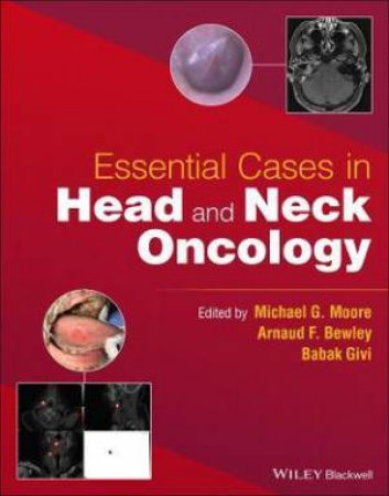 Essential Cases In Head And Neck Oncology by Michael G. Moore & Arnaud F. Bewley & Babak Givi