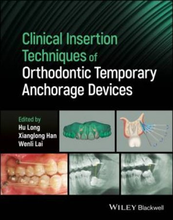 Clinical Insertion Techniques of Orthodontic Temporary Anchorage Devices by Hu Long & Xianglong Han & Wenli Lai