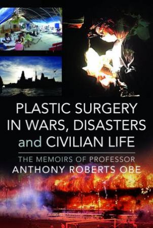 Plastic Surgery in Wars, Disasters and Civilian Life: The Memoirs of Professor Anthony Roberts OBE by ANTHONY ROBERTS