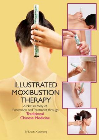 Illustrated Moxibustion Therapy by Duan Xuexhong