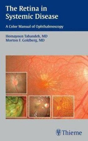 Retina in Systemic Disease by Homayoun Tabandeh