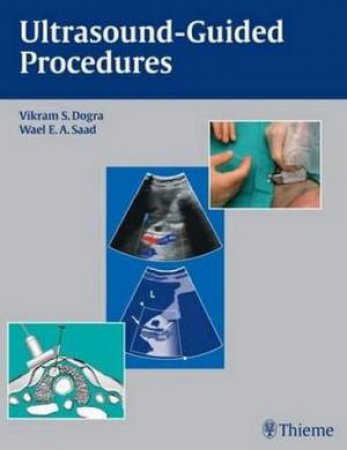 Ultrasound-guided Procedures by Vikram S. Dogra