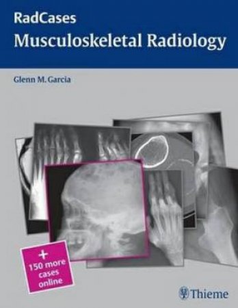 Musculoskeletal Radiology by Glenn Garcia