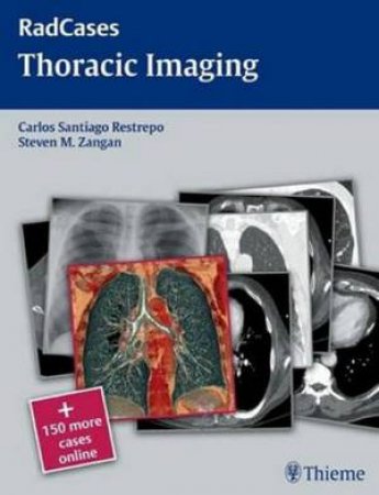 Thoracic Imaging by Steven Zangan