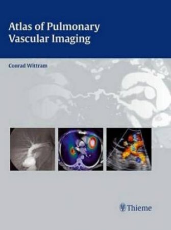 Atlas of Pulmonary Vascular Imaging by Conrad Wittram