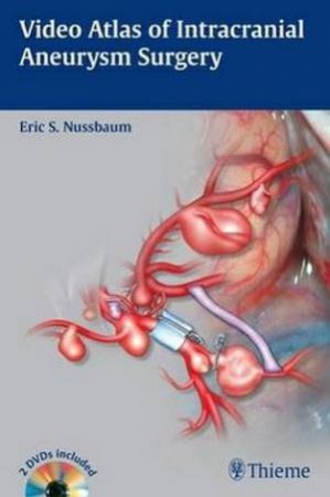 Video Atlas of Intracranial Aneurysm Surgery by Eric Nussbaum