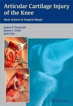 Articular Cartilage Injury of the Knee by et al Stannard