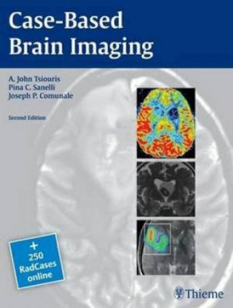 Case Based Brain Imaging by A. Tsiouris