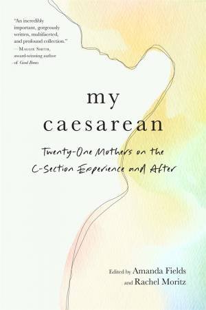 My Caesarean by Amanda Fields