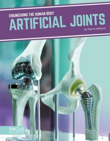 Engineering The Human Body: Artificial Joints by Marne Ventura