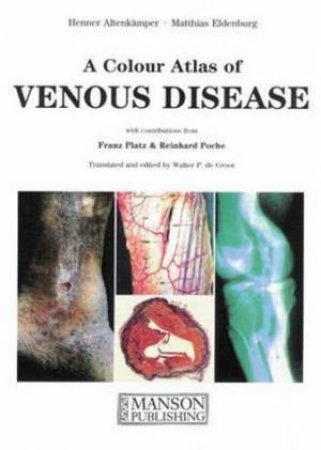 Venous Disease by Henner et al Altenkamper