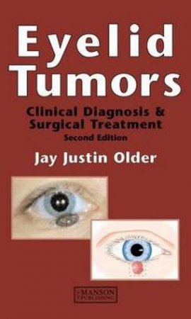 Eyelid Tumors H/C by Jay Justin et al Older