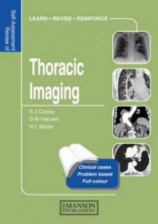 Thoracic Imaging by Sue et al Copley