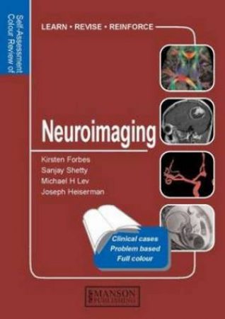 Neuroimaging by Kirsten et al Forbes