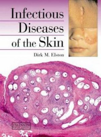 Infectious Diseases of the Skin H/C by Dirk M. et al Elston