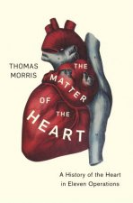 The Matter of the Heart A History of the Heart in Eleven Operations