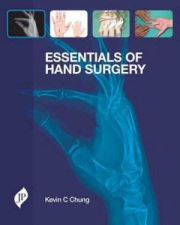 Essentials of Hand Surgery by Kevin C. Chung