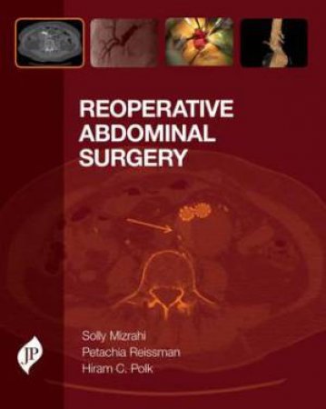 Reoperative Abdominal Surgery by Solly Mizrahi