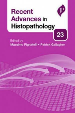 Recent Advances in Histopathology by Massimo Pignatelli