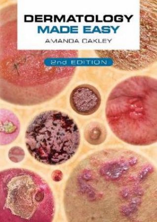 Dermatology Made Easy, second edition by Amanda Oakley