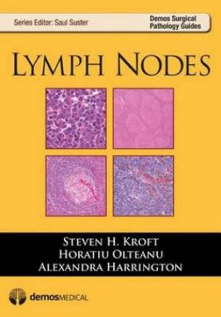 Lymph Nodes by Horatiu Olteanu