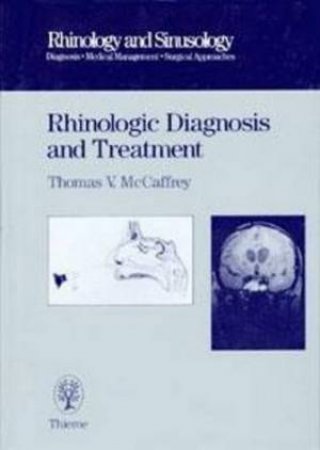 Rhinologic Diagnosis and Treatment by Thomas V. McCaffrey