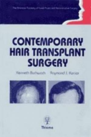 Contemporary Hair Transplant Surgery by K.A. Buchwach