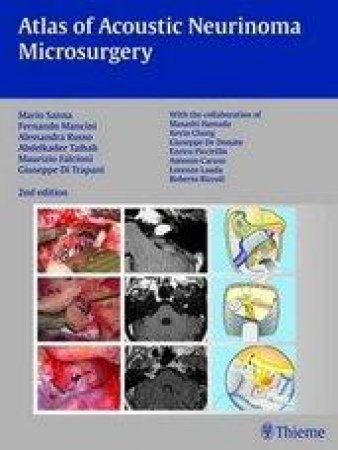 Atlas of Acoustic Neurinoma Microsurgery by Mario Sanna