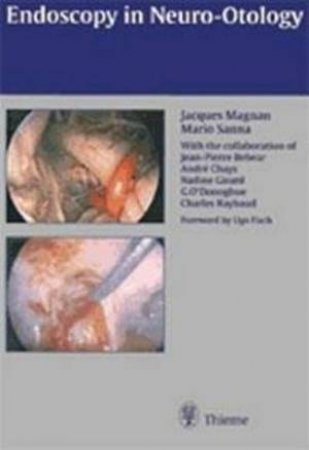 Endoscopy of Neurootology by J. Magnan